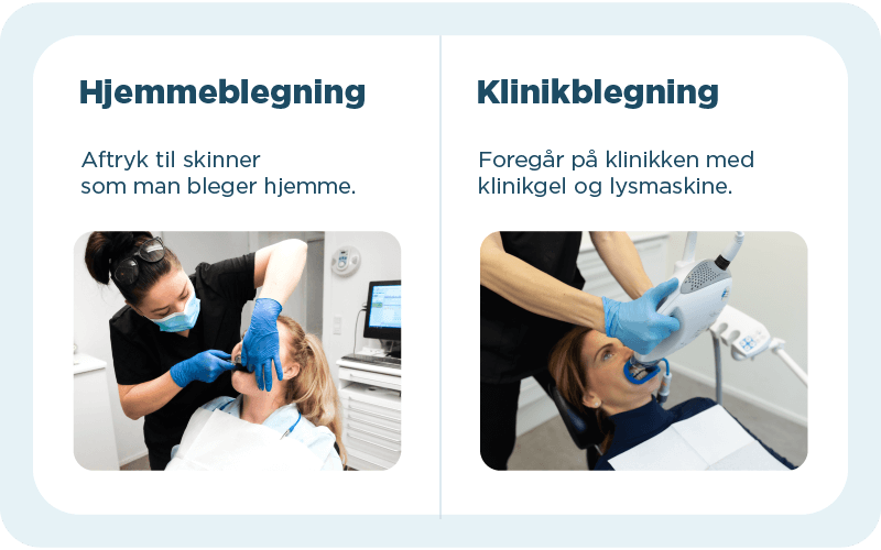 Tandblegning Frederikssund