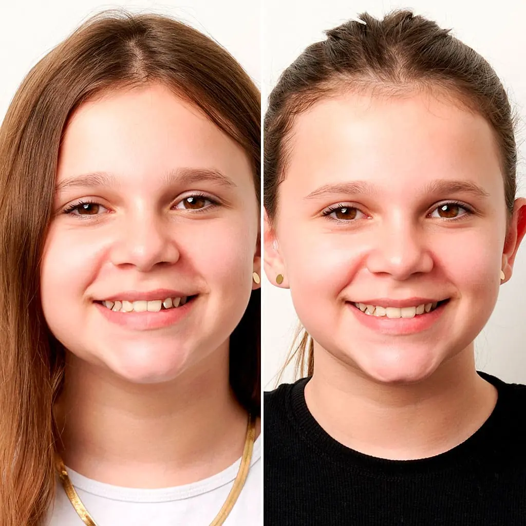 Tandregulering børn