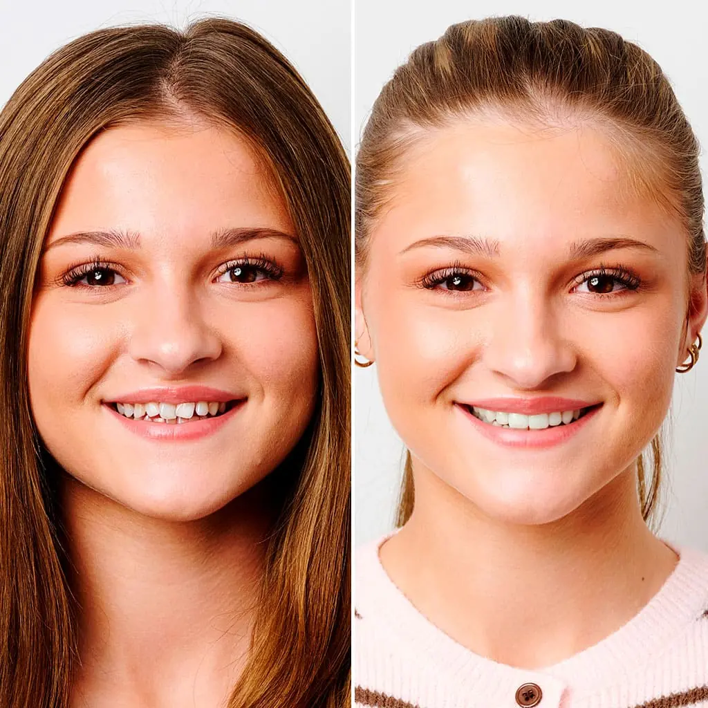 Tandregulering børn