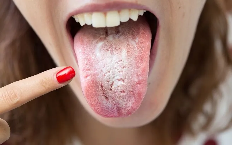 svamp på tungen