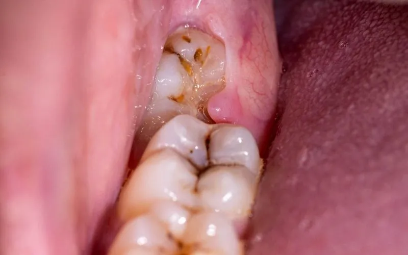 visdomstand på vej op og smerte