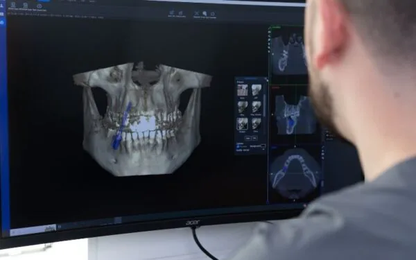 Digitale 3D-panoramaoptagelse