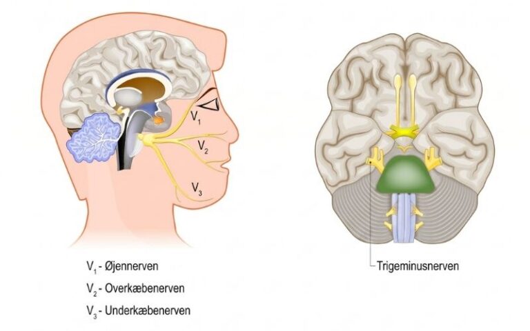 Trigeminusneuralgi: Ansigtssmerter og behandlingsmuligheder